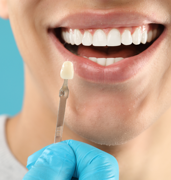 Smiling woman outside with healthy teeth
